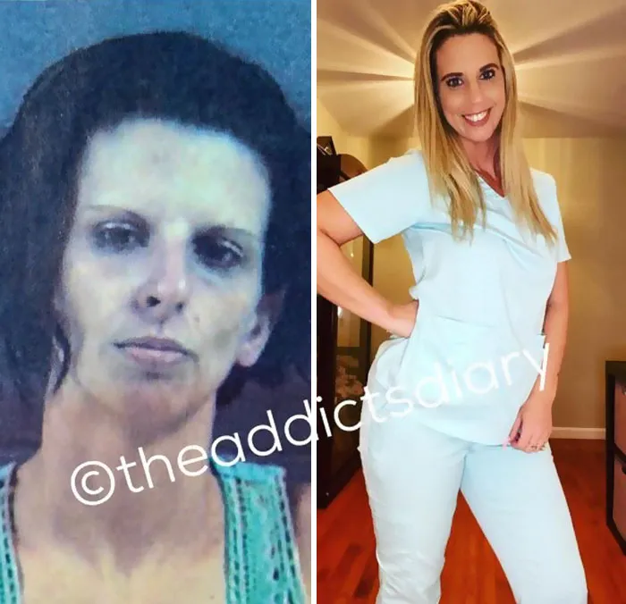 “Diario de un adicto”: 20 impactantes transformaciones de gente que solía ser adicta a las drogas (Nuevas historias)
