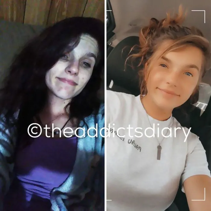 “Diario de un adicto”: 20 impactantes transformaciones de gente que solía ser adicta a las drogas (Nuevas historias)