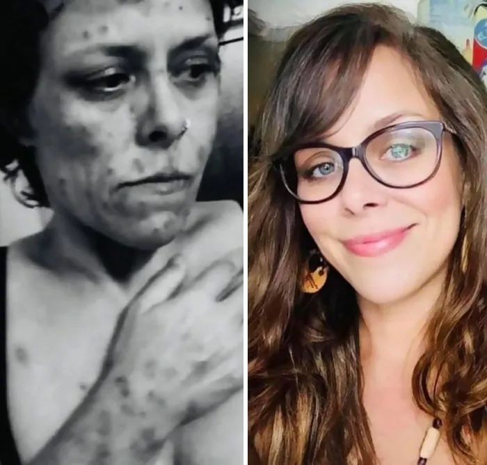 “Diario de un adicto”: 20 impactantes transformaciones de gente que solía ser adicta a las drogas (Nuevas historias)
