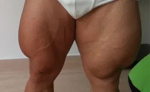 40 Fotos extrañas de atletas olímpicos y otros deportistas que te darán una nueva perspectiva del cuerpo humano