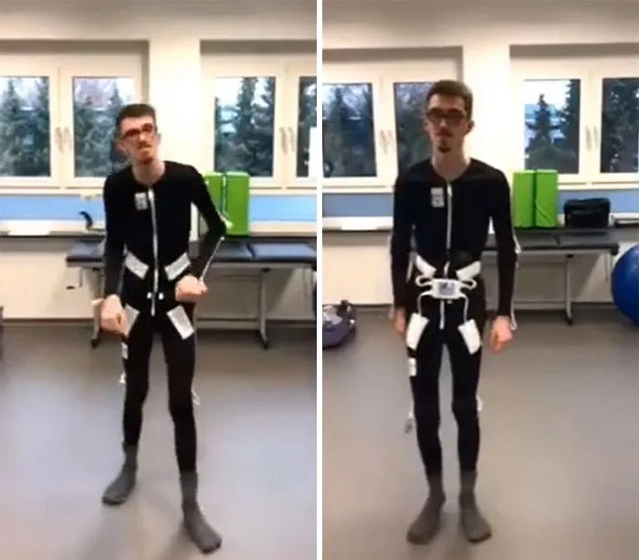 Este ingeniero sueco inventó un traje que le cambiará la vida por completo a aquellos que padecen Parkinson o han sufrido un derrame cerebral: ayuda a calmar los temblores utilizando estímulos eléctricos 