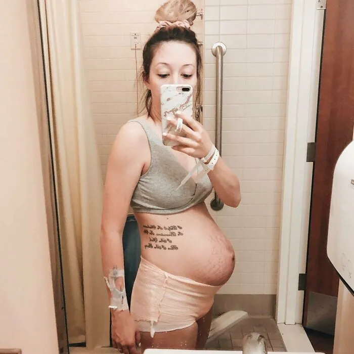 20 Fotos honestas de cuerpos postparto compartidas para mostrar la verdad de la que apenas se habla (nuevas fotos)
