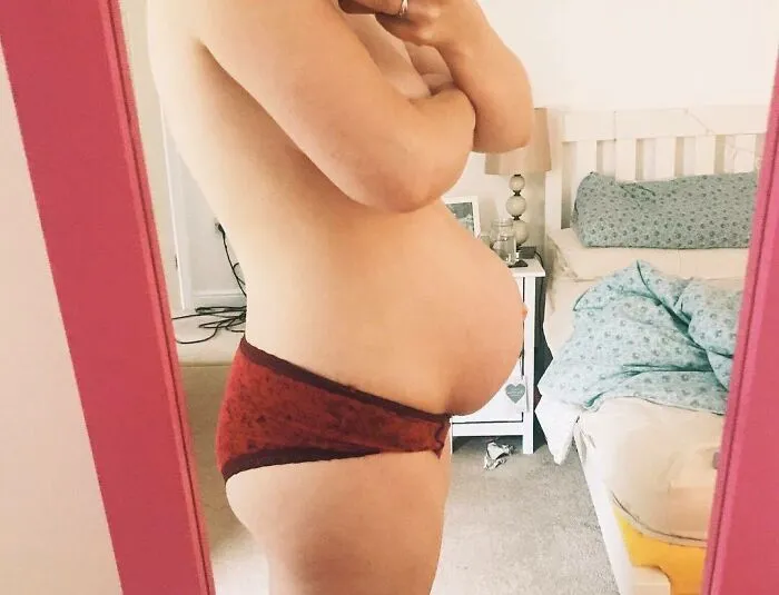 30 Honest Photos Of Post-Baby Bodies That Women Are Sharing To Reveal The Truth That Few People Talk About (New Pics)