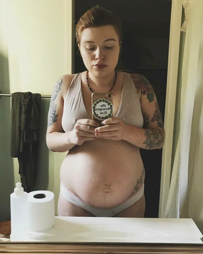 20 Fotos honestas de cuerpos postparto compartidas para mostrar la verdad de la que apenas se habla (nuevas fotos)