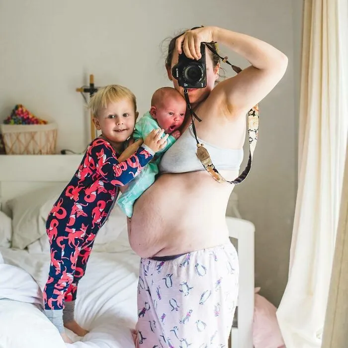 20 Fotos honestas de cuerpos postparto compartidas para mostrar la verdad de la que apenas se habla (nuevas fotos)