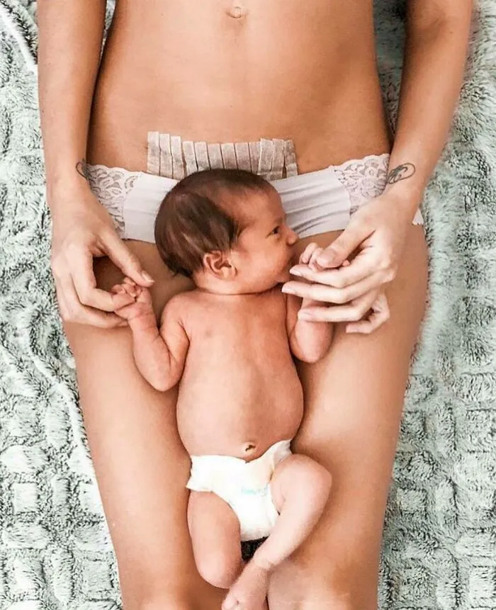 20 Fotos honestas de cuerpos postparto compartidas para mostrar la verdad de la que apenas se habla (nuevas fotos)