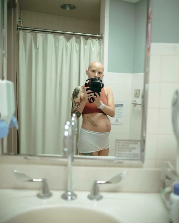 20 Fotos honestas de cuerpos postparto compartidas para mostrar la verdad de la que apenas se habla (nuevas fotos)