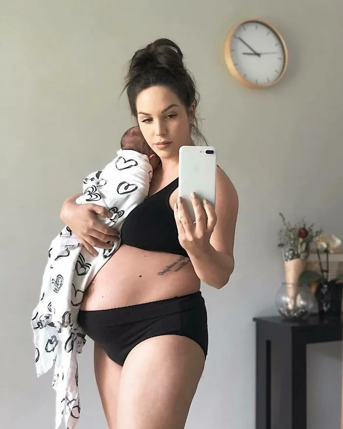 20 Fotos honestas de cuerpos postparto compartidas para mostrar la verdad de la que apenas se habla (nuevas fotos)