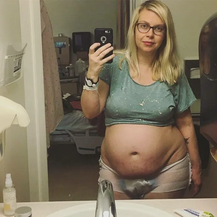 30 Honest Photos Of Post-Baby Bodies That Women Are Sharing To Reveal The Truth That Few People Talk About (New Pics)