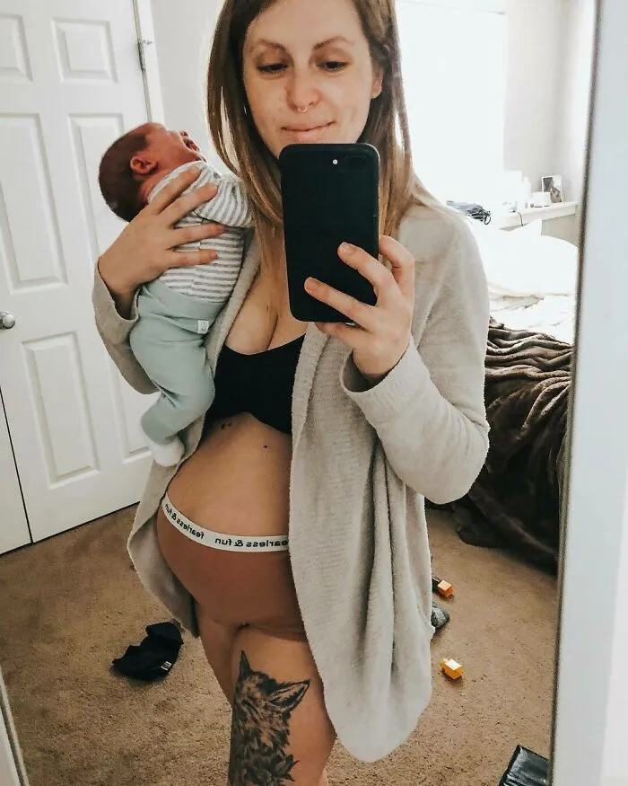 30 Honest Photos Of Post-Baby Bodies That Women Are Sharing To Reveal The Truth That Few People Talk About (New Pics)