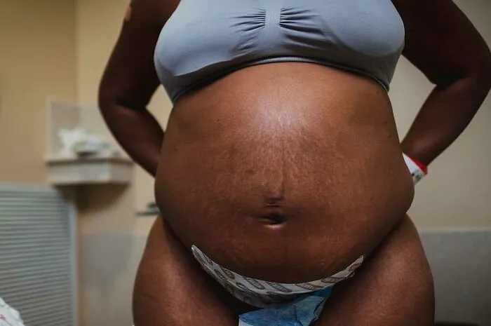 30 Honest Photos Of Post-Baby Bodies That Women Are Sharing To Reveal The Truth That Few People Talk About (New Pics)