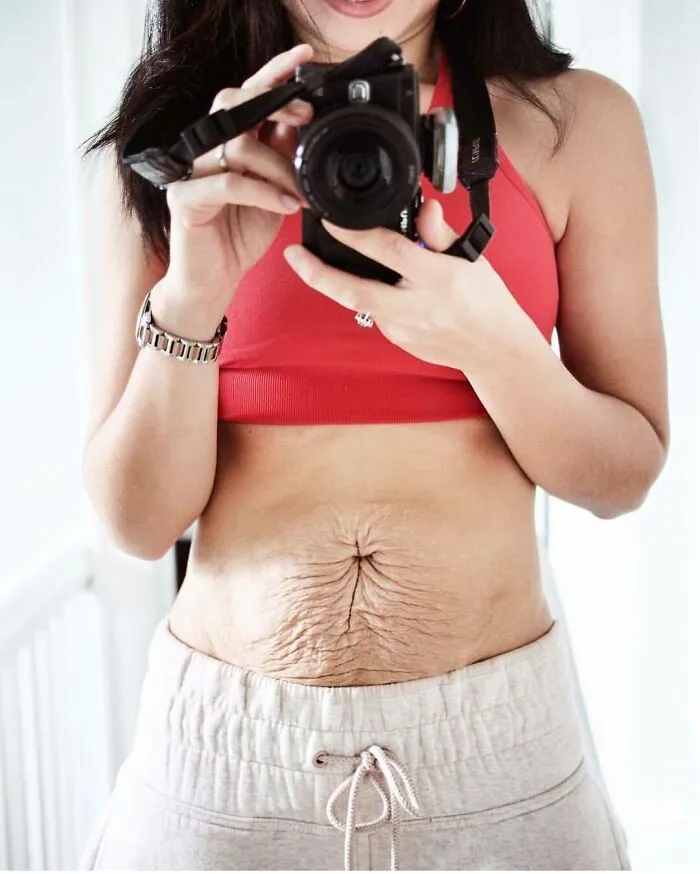 30 Honest Photos Of Post-Baby Bodies That Women Are Sharing To Reveal The Truth That Few People Talk About (New Pics)