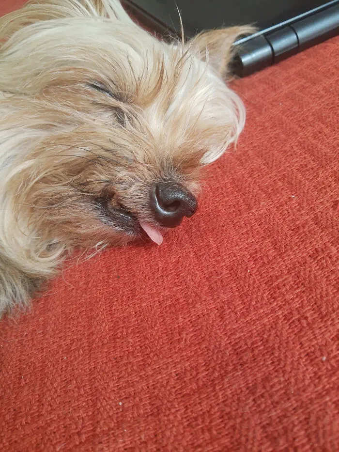 11 Yo, Lost Most His Teeth So His Tongue Slips Out