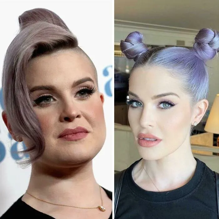 Photoshop? Filters? Surgery? Yes