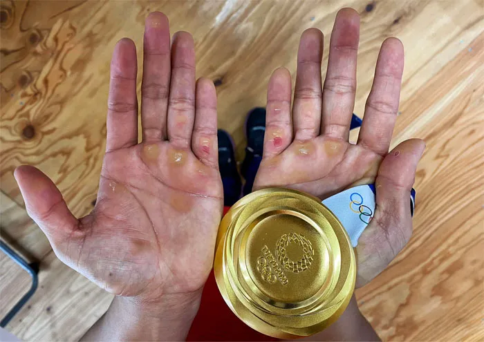 The Hands Of Hidilyn Diaz After Winning Her Country's First Olympic Gold Medal