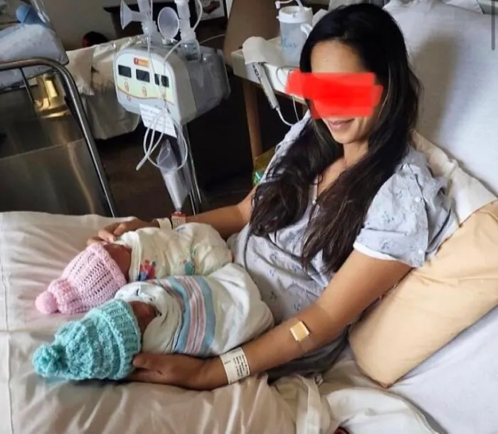 Tras quedar amputada, esta mujer acaricia lo que queda de sus piernas