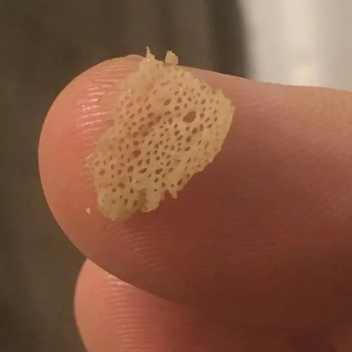 Comí demasiados caramelos ácidos y mi lengua decidió soltar una capa