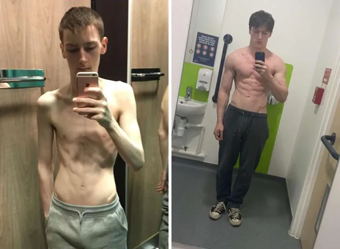 Así vencí a la anorexia: esta fue mi transformación en 2 años