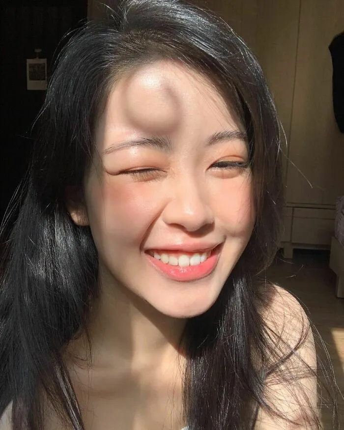 Shadow Of The Hair On The Forehead Looks Like A Bump