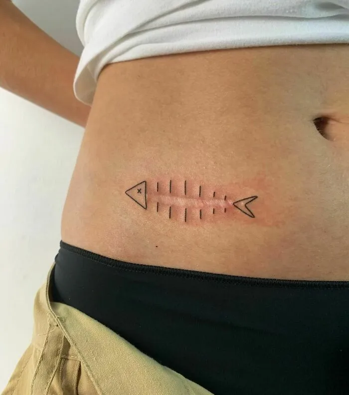 Very Interesting Custom Project Around A Scar. I Guess I Could Call It “Scar Upcycling”