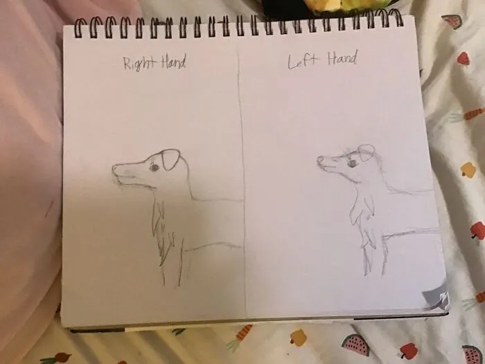 The Difference Between My Right Hand And Left Hand. This Is My Dog Jack.
