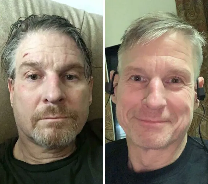 A Year Ago I Was Depressed And Suicidal. Today Things Have Gotten Better
