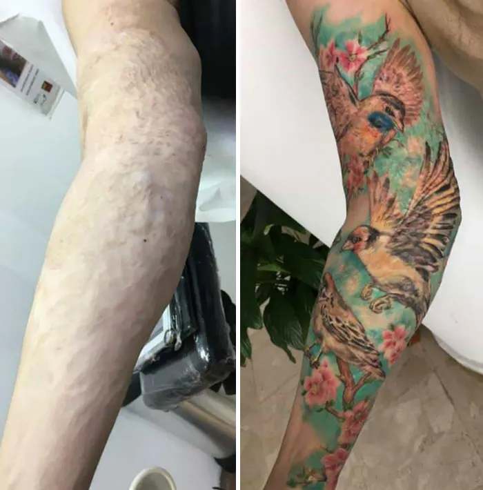 My Nephew Finally Had His Burning Scars Covered With A Tattoo. I Am So Proud Of My Boy! Made Me Smile And Also Made Me Cry Of Happiness