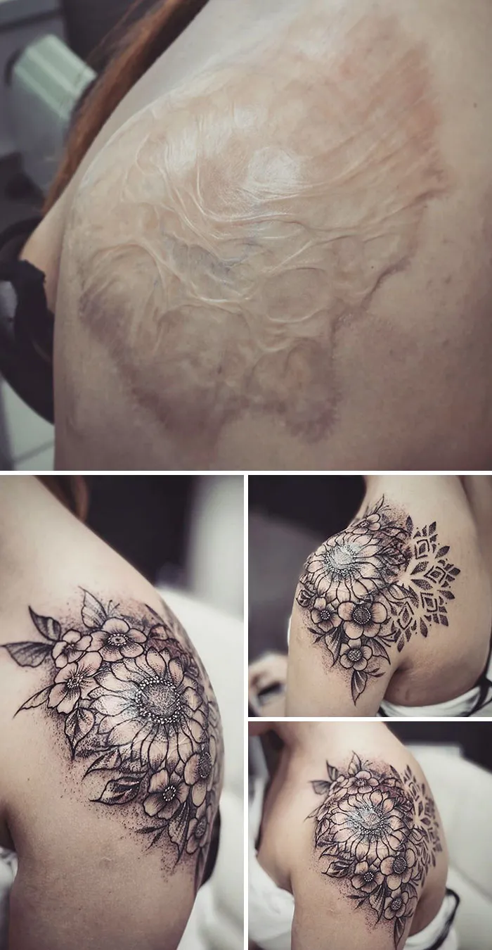 Floral tattoo covers shoulder scar, showcasing creative transformation and artistry by tattoo artists.