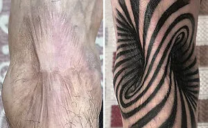 50 Times People Asked Tattoo Artists To Cover Up Their Scars And Birthmarks And Couldn't Be Happier With The Result