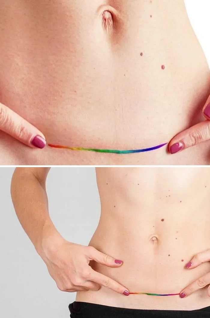 Tattoo covers scar with a rainbow design, transforming a birthmark into art.