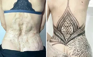 50 Times People Asked Tattoo Artists To Cover Up Their Scars And Birthmarks And Couldn't Be Happier With The Result