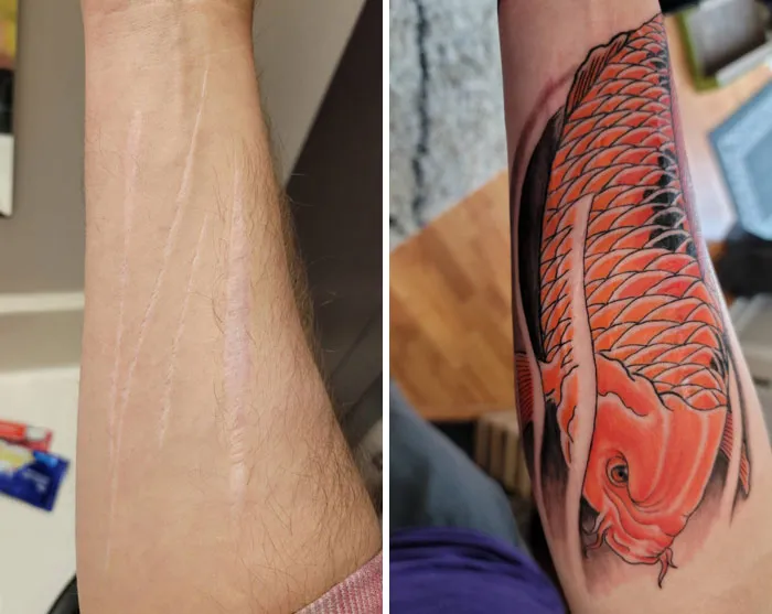 Tattoo covers arm scars with vivid koi fish design, enhancing appearance and confidence.