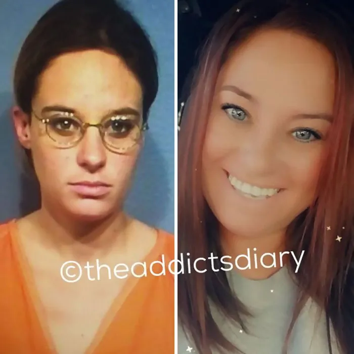 “Diario de un adicto”: 20 impactantes transformaciones de gente que solía ser adicta a las drogas (Nuevas historias)