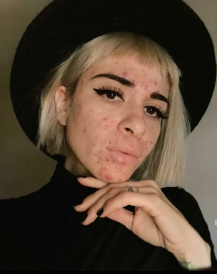 Sanity Sunday - She Never Hides Her Flaws, And She Looks Flawlessly Beautiful In Her Own Confidence