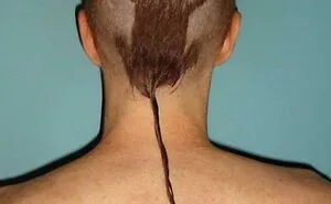 50 Tragic Hair Accidents, As Shared In This Online Community (New Pics)