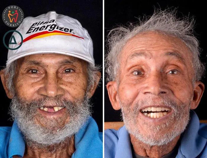 Brazilian Dentist Travels To Treat The Teeth Of Poor People For Free And Here Are 30 Transformations