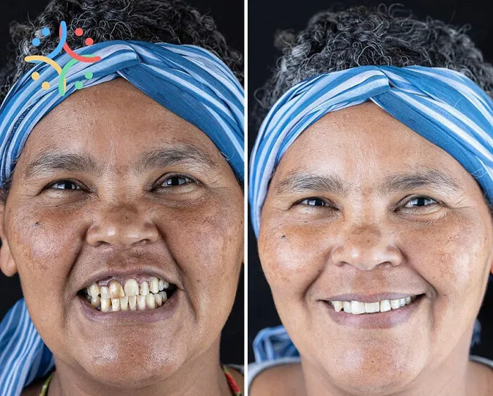 Brazilian Dentist Travels To Treat The Teeth Of Poor People For Free And Here Are 30 Transformations