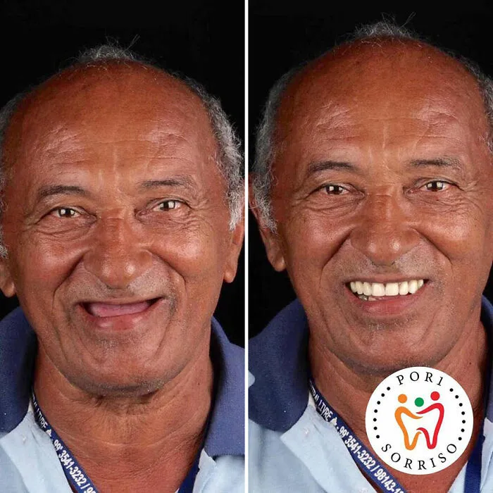 Brazilian Dentist Travels To Treat The Teeth Of Poor People For Free And Here Are 30 Transformations