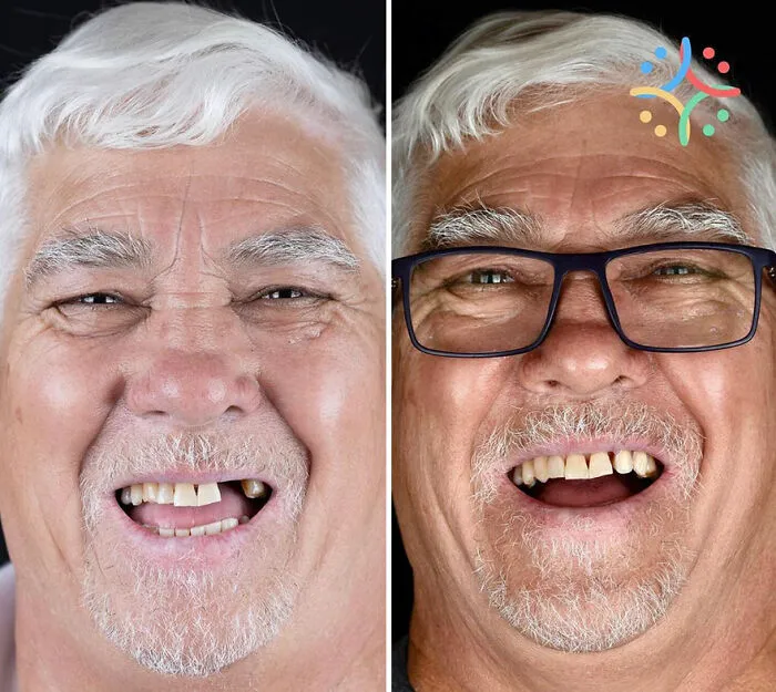 Brazilian Dentist Travels To Treat The Teeth Of Poor People For Free And Here Are 30 Transformations