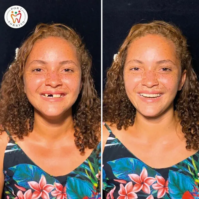 Brazilian Dentist Travels To Treat The Teeth Of Poor People For Free And Here Are 30 Transformations