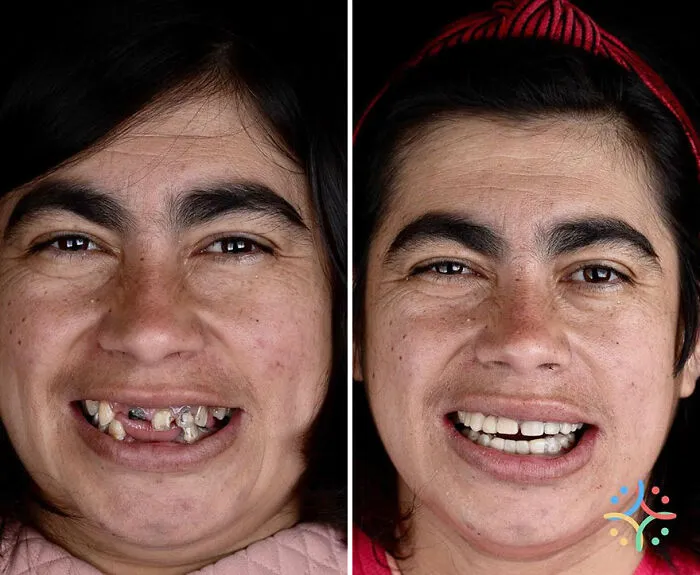 Brazilian Dentist Travels To Treat The Teeth Of Poor People For Free And Here Are 30 Transformations
