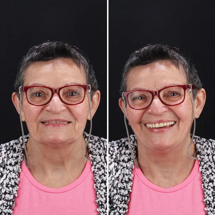 Brazilian Dentist Travels To Treat The Teeth Of Poor People For Free And Here Are 30 Transformations