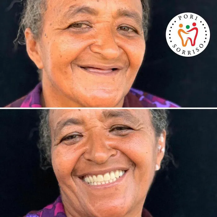 Brazilian Dentist Travels To Treat The Teeth Of Poor People For Free And Here Are 30 Transformations