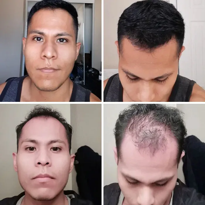 After 4.5 Months