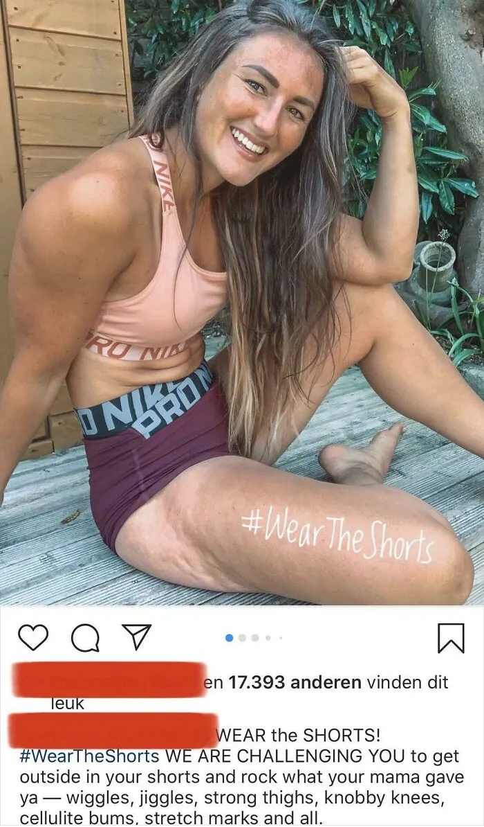 To The People On My Last Post Here That Said Cellulite Shouldn’t Be On Strong Legs