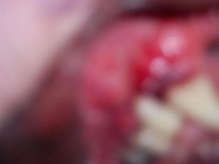 Have No Idea, I Think It Is A Picture Of A Wound On One Of My Dogs' Gums.