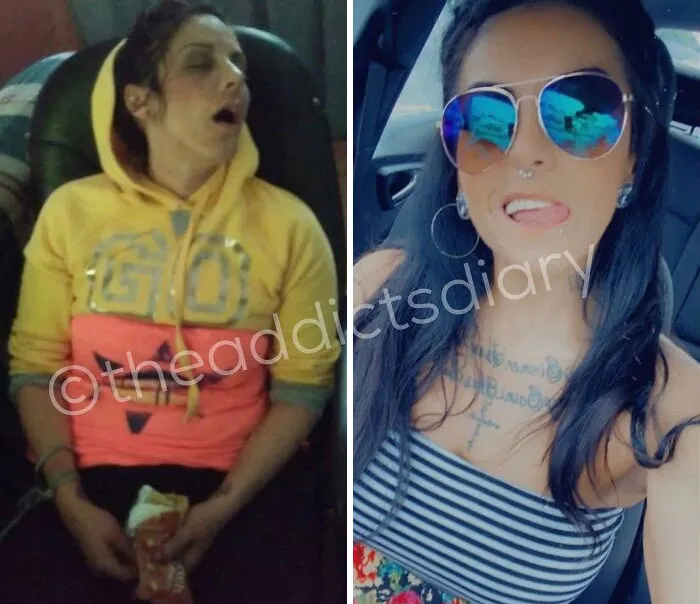 ‘The Addict’s Diary’: 30 Powerful Before & After Transformations Of Drug Addicts (New Stories)