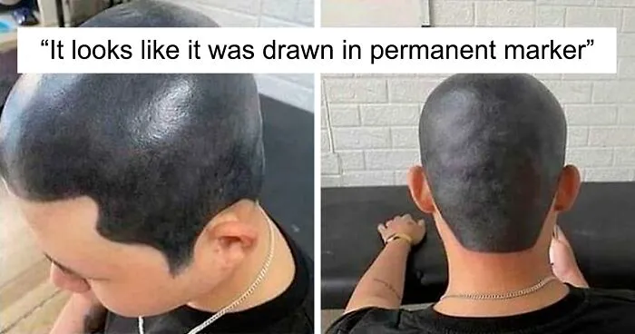 50 Tragic Hair Accidents, As Shared In This Online Community (New Pics)