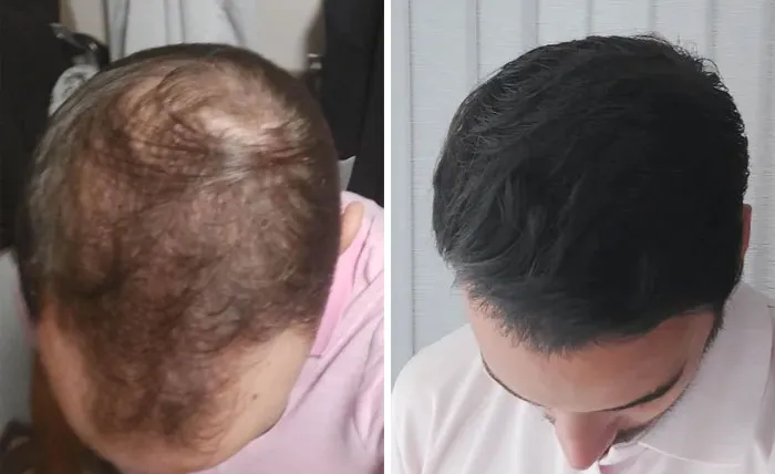 After 8 Months