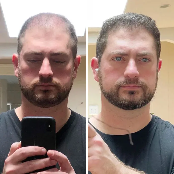 After A 1 Year
